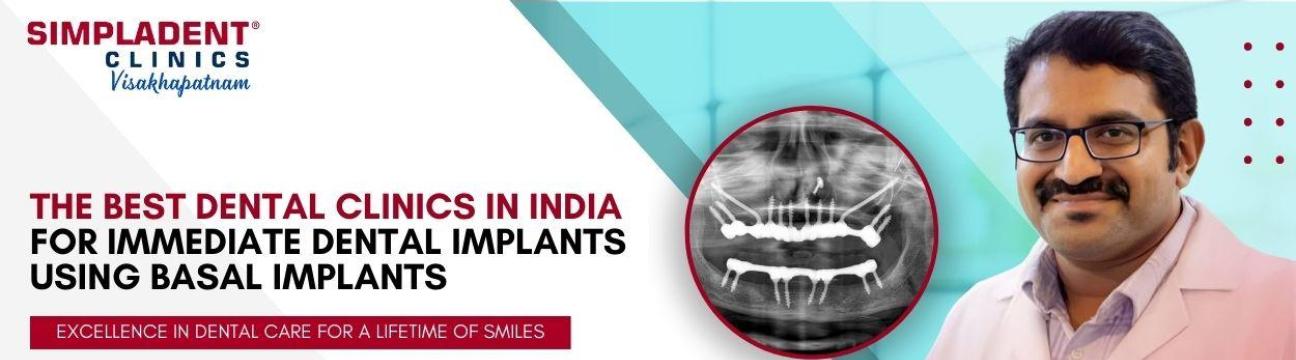 Full Mouth Dental  Implants Surgery