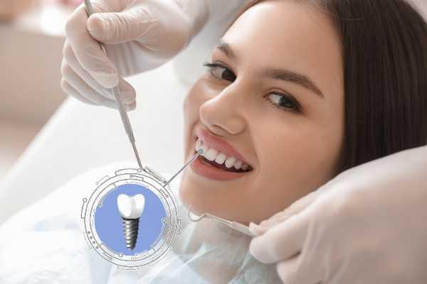 Dental implants Canterbury