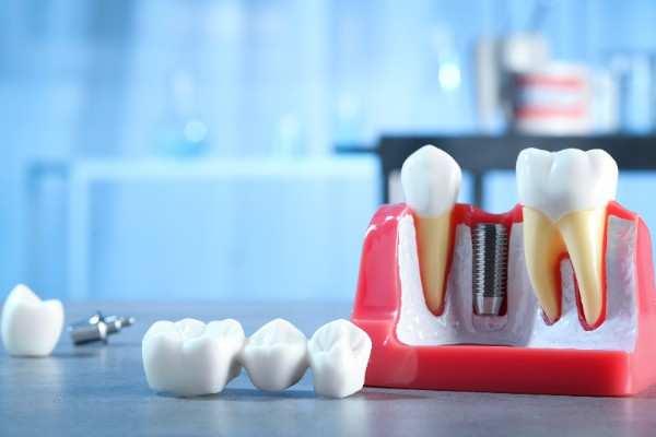 invisalign Kilmarnock