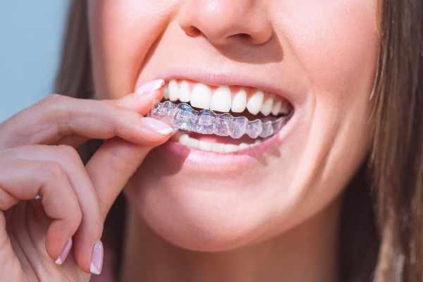emergency dentist in Llandudno