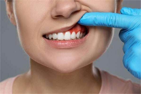 Gums Swollen Overnight? It’s Time to Take Action in Blackburn